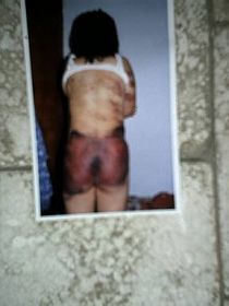 圖：濰坊警察把大法弟子的妻子（常人）綁架、毒打後的照片。