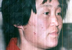 圖：趙鳳英被宋樹靈用煙頭燙燒後第三天被劫回當地，在紅沙溝派出裏警察給照的照片。