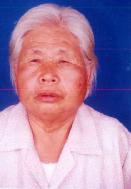 郭福香老人被暴打後，臉部紅腫、帶血痕的照片。