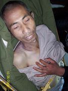 自2009年2月25日被綁架到2009年10月25日被迫害致死，年僅46歲的黃立忠被折磨得皮包骨、傷痕累累。