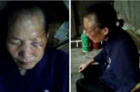 '譚翠英遭國保警察暴打後的照片，老人雙目緊閉，傷痕累累。'