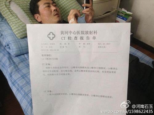 '被警察毆打後住在醫院的律師張俊傑，醫生診斷腰椎三處骨折'