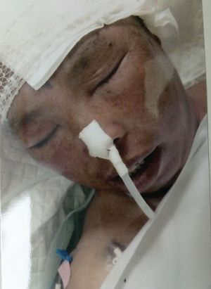 '石雲蘭被中共警察毆打致癱瘓'