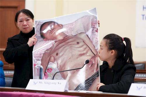 '圖4：今年十七歲的徐鑫洋和媽媽遲麗華在美國國會展示了一幅她的爸爸徐大為被中共迫害得瘦骨嶙峋，滿身傷痕，奄奄一息的照片。'