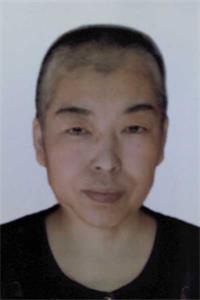 李國俊被迫害化療後的照片