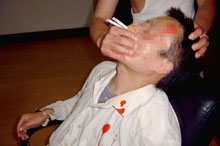 酷刑演示：將兩根煙同時點著插入法輪功學員的鼻孔，把嘴捂住。熏嗆、窒息極為痛苦