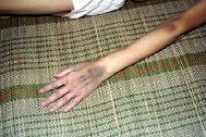 照片是蔣美蘭被營救回家後，第二天拍的，蔣美蘭全身瘦的只剩皮包骨，她的手臂青紫都是打點滴打的。