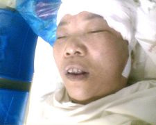 陳玉梅被惡警打成重傷後在醫院的照片