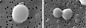 Primo经络管的超微型细胞「活卵（左图）」在分裂的过程（右图）。「活卵」具有其它细胞没有的完全不一样的细胞特性。