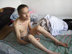 邱清華被迫害得瘦骨嶙峋，放回家後的照片