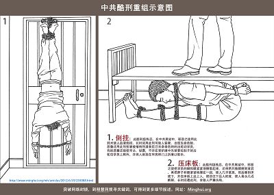 中国民主党反酷刑观察：酷刑照片 揭露中共黑獄迫害