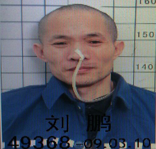 圖為上海法輪功學員劉鵬被「強制灌食」酷刑折磨的慘狀