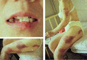 這三張照片是任平遭強暴後第十三天拍攝
