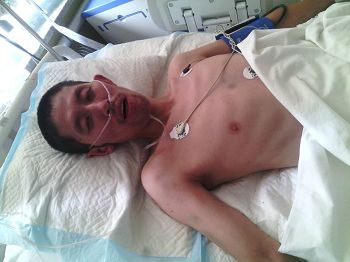 張國立在莊河中心醫院重症監護室（ICU），胳膊和胸口處可以看出在看守所被毆打後的青紫