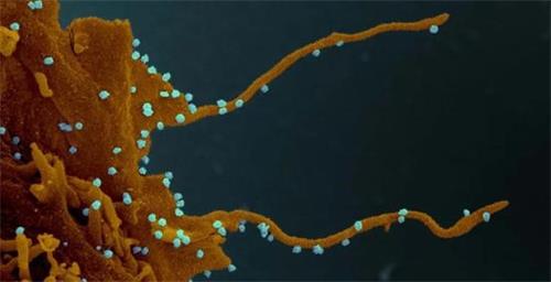 '圖2：細胞被武漢肺炎（新冠病毒）感染後形成大量釋放病毒的偽足（示意圖，白色顆粒示病毒顆粒，圖片自Elizabeth Fischer， Microscopy Unit NIH/NIAID.）'