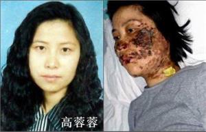 '高蓉蓉被迫害前被電擊後毀容的臉'